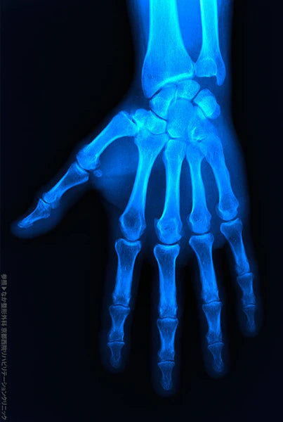 What is a wrist diagnosis?